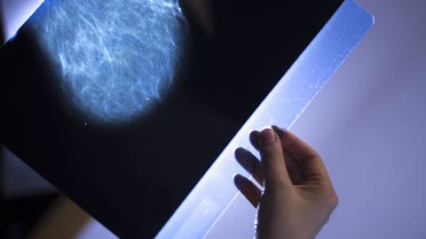 El Rio extiende a noviembre su programa de mamografías gratis